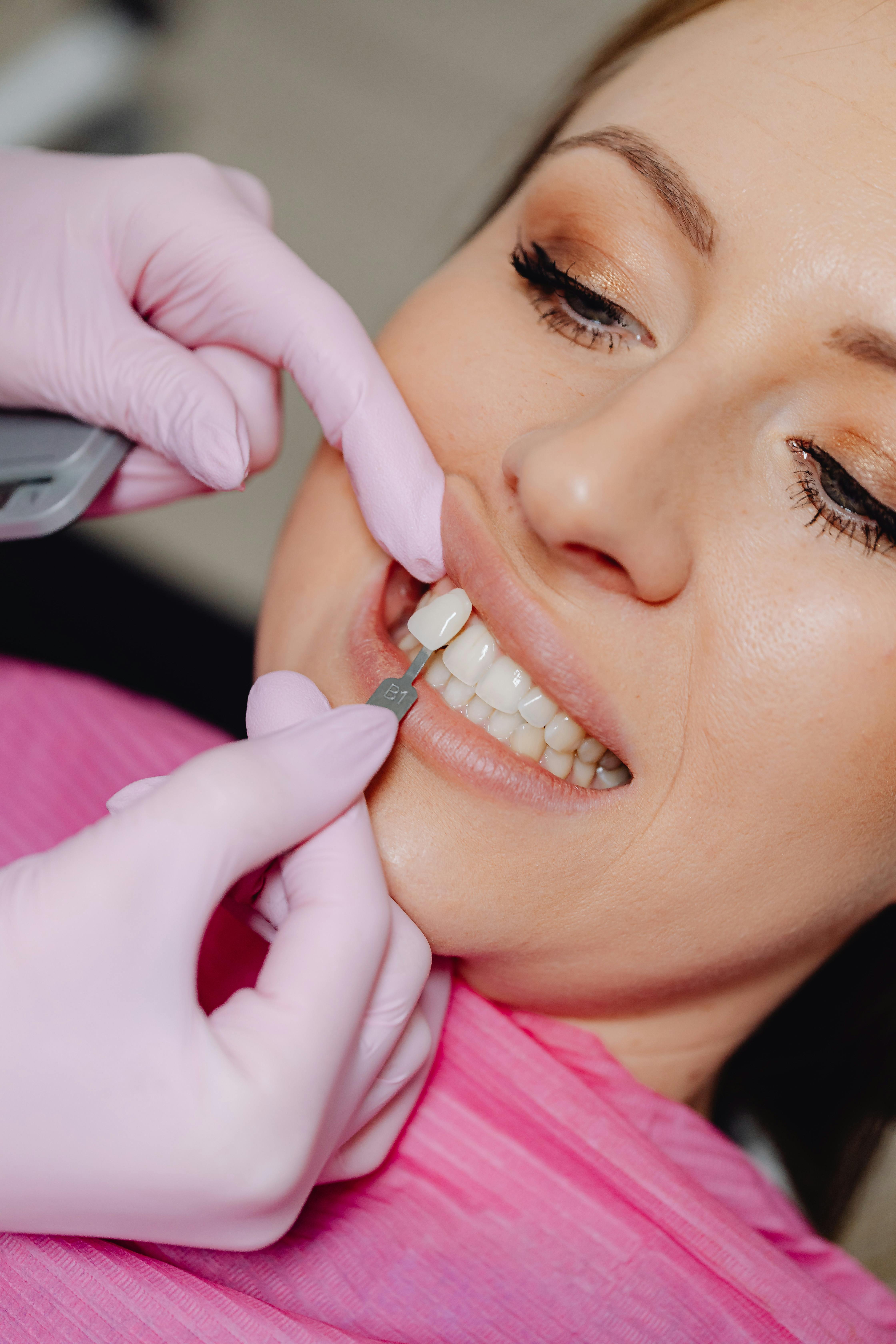 Aesthetics Dentistry
